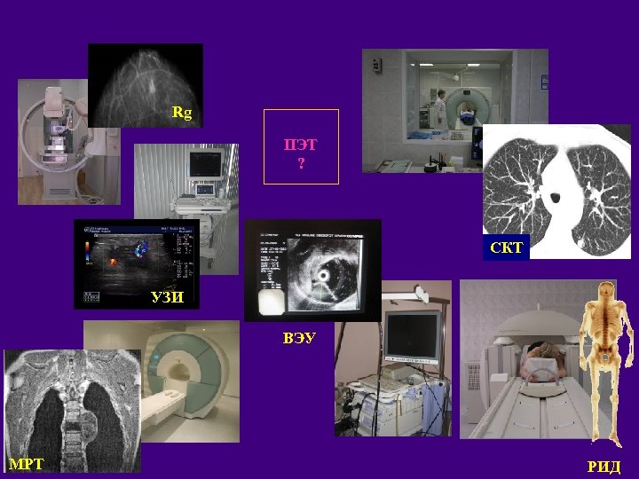 Rg ПЭТ ? СКТ УЗИ ВЭУ МРТ РИД 
