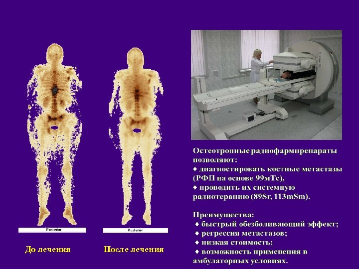 До лечения После лечения 