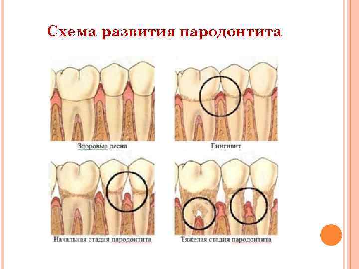 Карта исследования пародонта