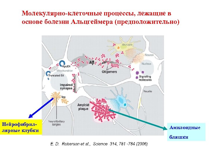 Молекулярно-клеточные процессы, лежащие в основе болезни Альцгеймера (предположительно) Нейрофибриллярные клубки Амилоидные бляшки 