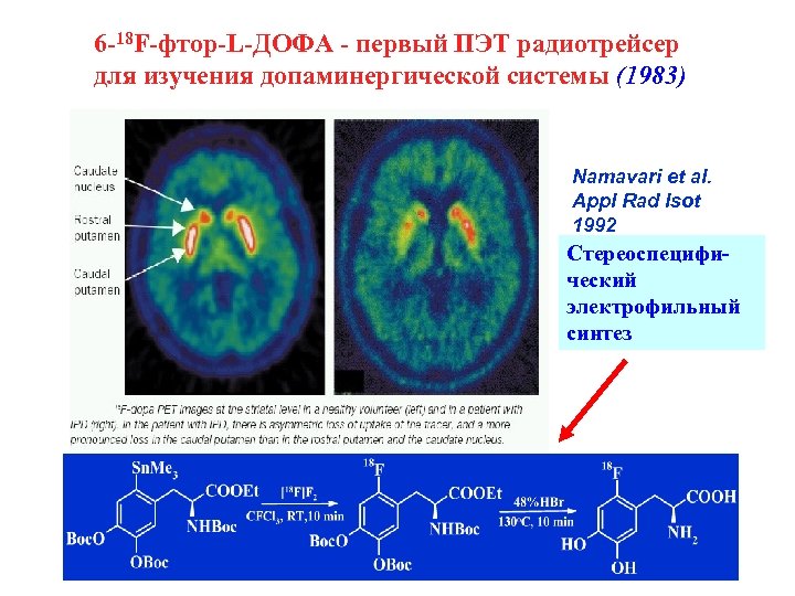 6 -18 F-фтор-L-ДОФА - первый ПЭТ радиотрейсер для изучения допаминергической системы (1983) Namavari et