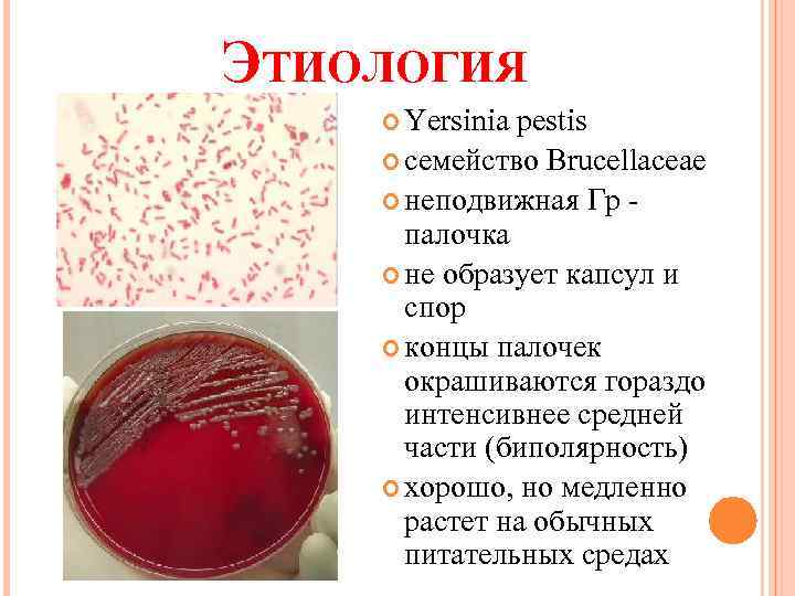 ЭТИОЛОГИЯ Yersinia pestis семейство Brucellaceae неподвижная Гр палочка не образует капсул и спор концы