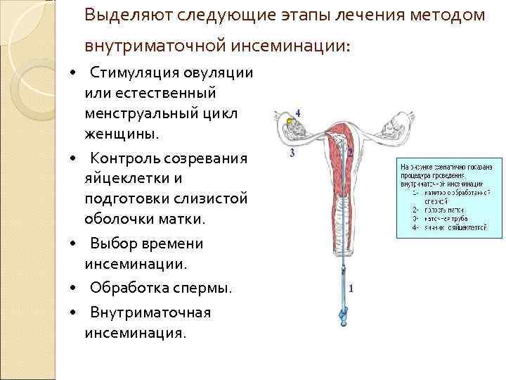 Инсеминация какие анализы