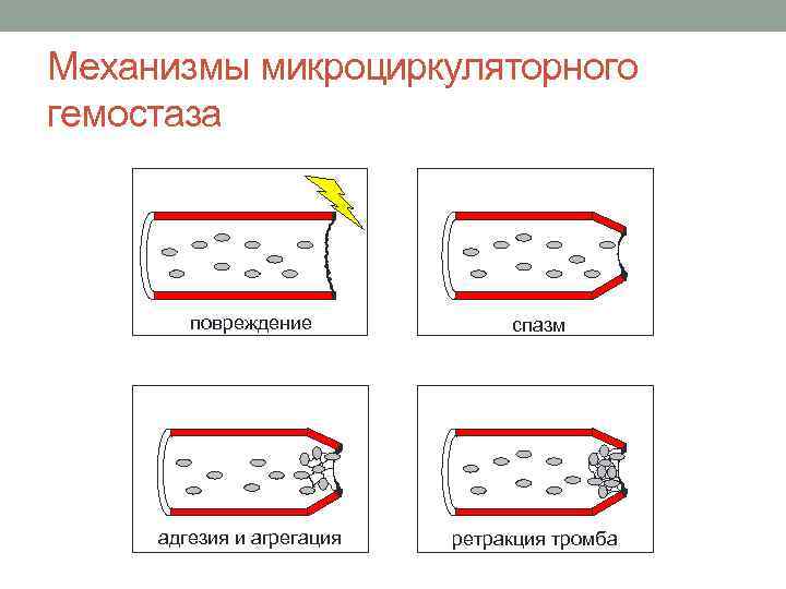 Механизмы микроциркуляторного гемостаза повреждение спазм адгезия и агрегация ретракция тромба 