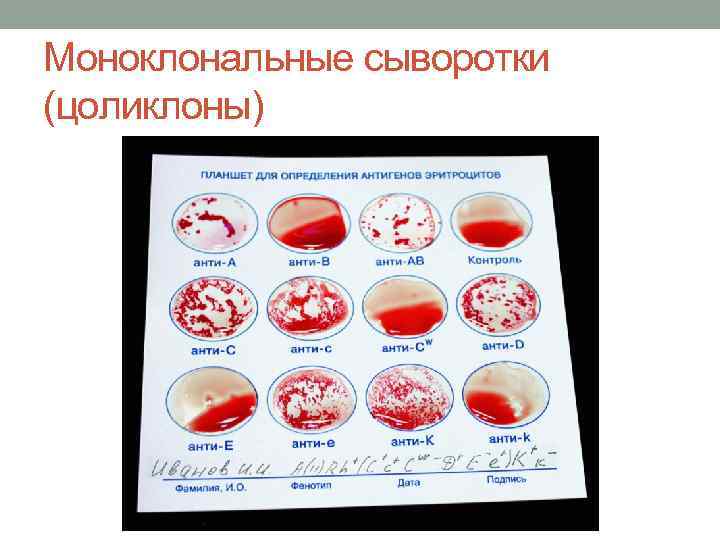 Моноклональные сыворотки (цоликлоны) 