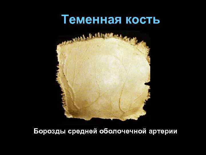 Теменная кость Борозды средней оболочечной артерии 