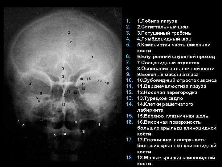 1. 2. 3. 4. 5. 6. 7. 8. 9. 10. 11. 12. 13. 14.