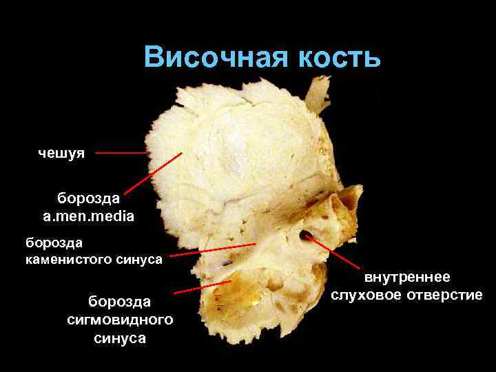 Мозговой череп птиц. Височная кость кость черепа. Височная кость борозда сигмовидного синуса. Борозда Нижнего Каменистого синуса височная кость. Чешуйчатая кость височной кости.