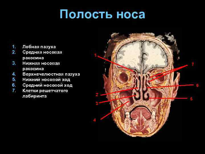 Полость носа 1. 2. 3. 4. 5. 6. 7. Лобная пазуха Средняя носовая раковина