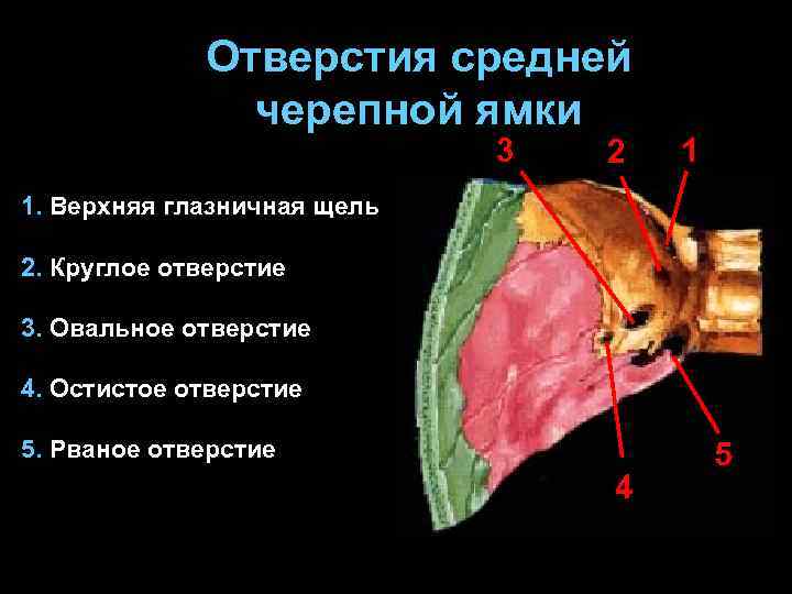 Отверстия средней черепной ямки 3 2 1 1. Верхняя глазничная щель 2. Круглое отверстие