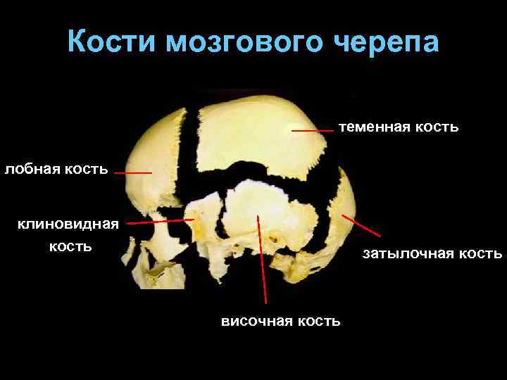 Теменная кость черепа фото