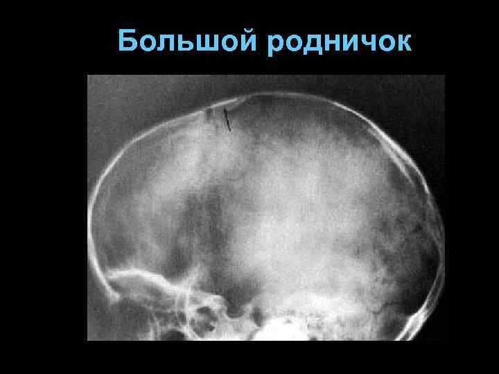 Большой родничок 