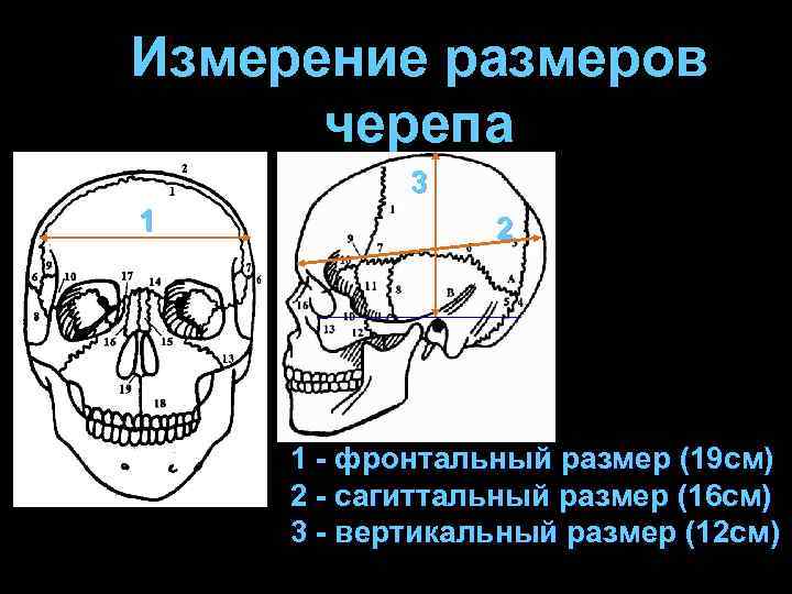 Усиление рисунка сосудистых борозд черепа - 84 фото