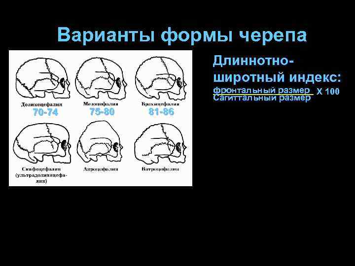 Варианты формы черепа. Форма черепа. Три основные формы черепа.