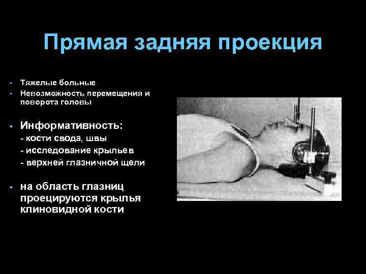 Прямая задняя проекция § Тяжелые больные Невозможность перемещения и поворота головы § Информативность: §