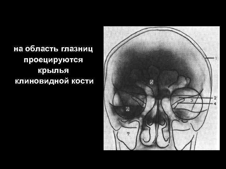на область глазниц проецируются крылья клиновидной кости 