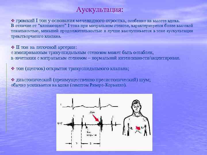 Какие симптомы характерны для аускультативной картины недостаточности митрального клапана тест