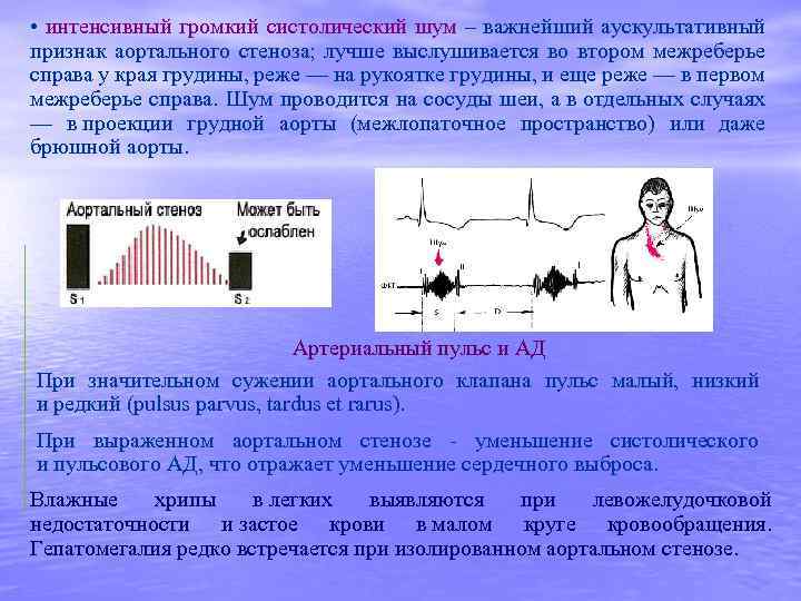 Аускультативная картина при открытом артериальном протоке характеризуется наличием