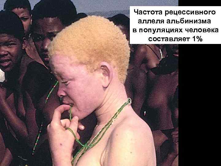 Частота рецессивного аллеля альбинизма в популяциях человека составляет 1% 