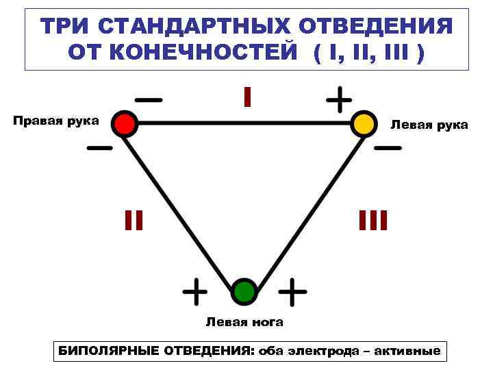 ТРИ СТАНДАРТНЫХ ОТВЕДЕНИЯ ОТ КОНЕЧНОСТЕЙ ( I, III ) I Правая рука Левая рука