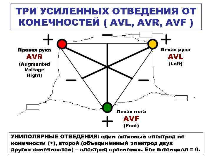 ТРИ УСИЛЕННЫХ ОТВЕДЕНИЯ ОТ КОНЕЧНОСТЕЙ ( AVL, AVR, AVF ) Правая рука Левая рука