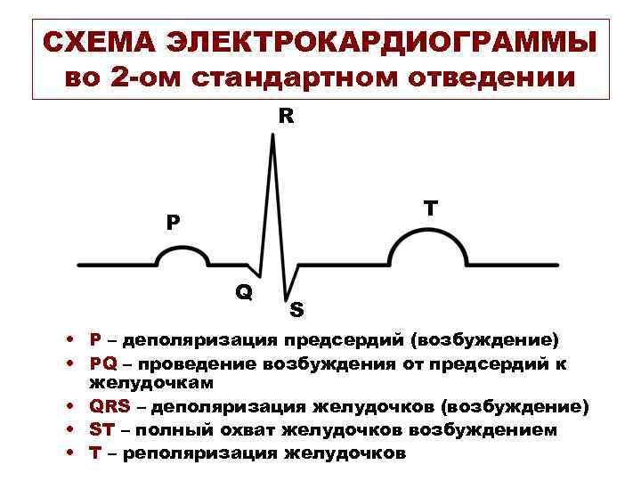 СХЕМА ЭЛЕКТРОКАРДИОГРАММЫ во 2 -ом стандартном отведении R T P Q S • P