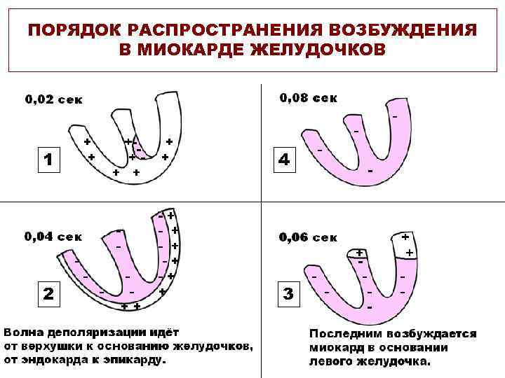 ПОРЯДОК РАСПРОСТРАНЕНИЯ ВОЗБУЖДЕНИЯ В МИОКАРДЕ ЖЕЛУДОЧКОВ 1 4 2 3 