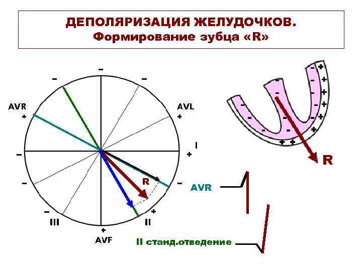 ДЕПОЛЯРИЗАЦИЯ ЖЕЛУДОЧКОВ. Формирование зубца «R» R AVR II станд. отведение 