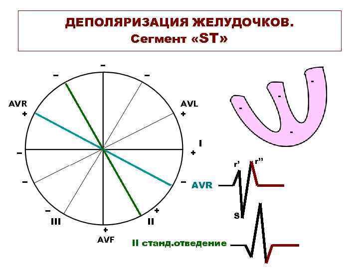 ДЕПОЛЯРИЗАЦИЯ ЖЕЛУДОЧКОВ. Сегмент «ST» - - r’ AVR S II станд. отведение r’’ 