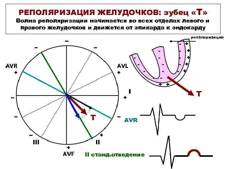 РЕПОЛЯРИЗАЦИЯ ЖЕЛУДОЧКОВ: зубец «Т» Волна реполяризации начинается во всех отделах левого и правого желудочков
