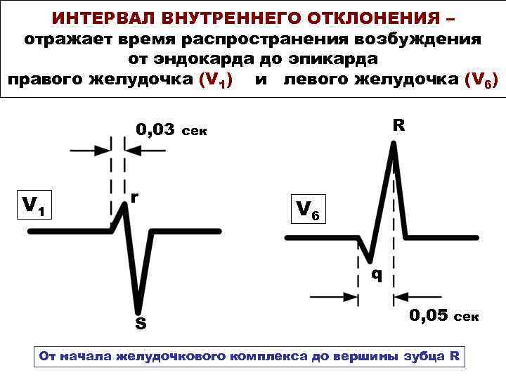 ИНТЕРВАЛ ВНУТРЕННЕГО ОТКЛОНЕНИЯ – отражает время распространения возбуждения от эндокарда до эпикарда правого желудочка