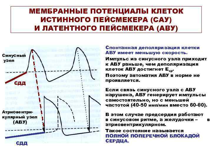 МЕМБРАННЫЕ ПОТЕНЦИАЛЫ КЛЕТОК ИСТИННОГО ПЕЙСМЕКЕРА (САУ) И ЛАТЕНТНОГО ПЕЙСМЕКЕРА (АВУ) Синусный узел СДД Атриовентрикулярный