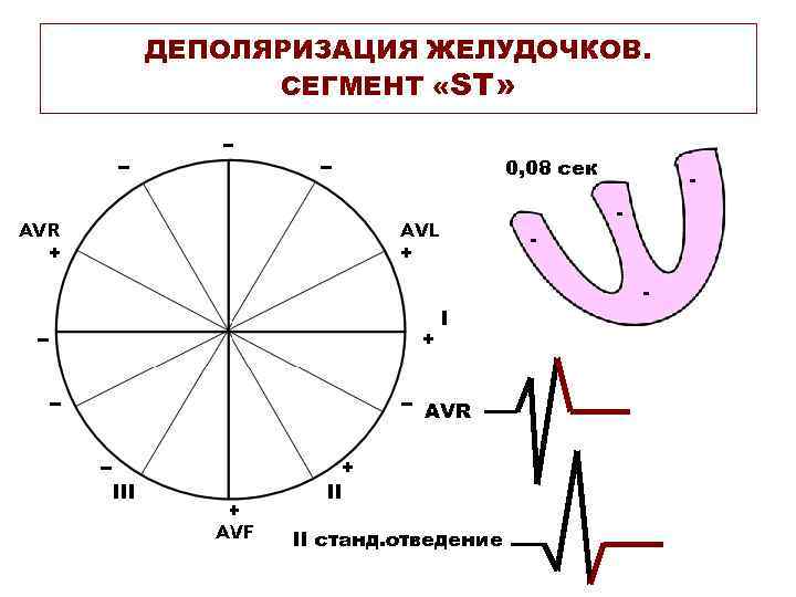 ДЕПОЛЯРИЗАЦИЯ ЖЕЛУДОЧКОВ. СЕГМЕНТ «ST» 0, 08 сек - - - AVR II станд. отведение