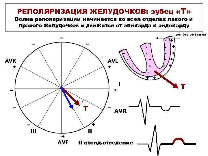 РЕПОЛЯРИЗАЦИЯ ЖЕЛУДОЧКОВ: зубец «Т» Волна реполяризации начинается во всех отделах левого и правого желудочков