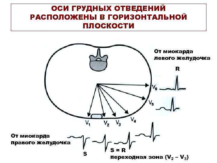 ОСИ ГРУДНЫХ ОТВЕДЕНИЙ РАСПОЛОЖЕНЫ В ГОРИЗОНТАЛЬНОЙ ПЛОСКОСТИ От миокарда левого желудочка R От миокарда