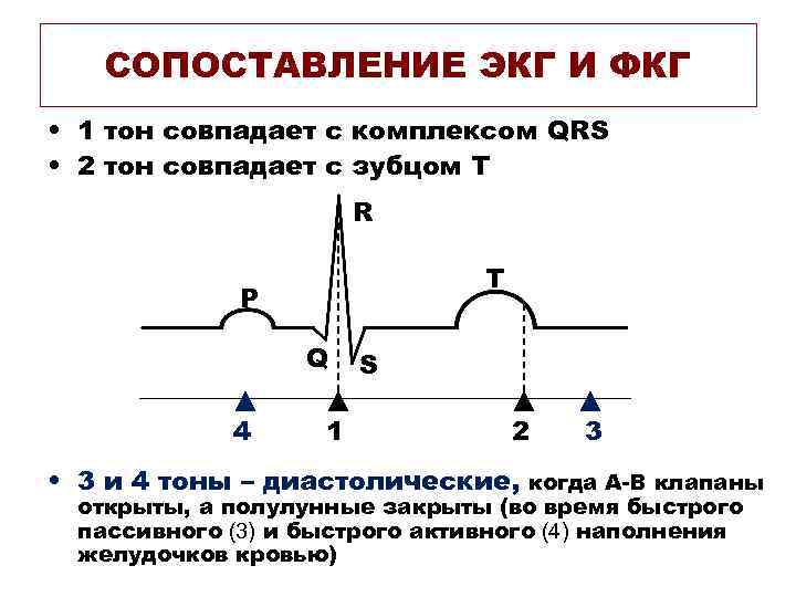 СОПОСТАВЛЕНИЕ ЭКГ И ФКГ • 1 тон совпадает с комплексом QRS • 2 тон