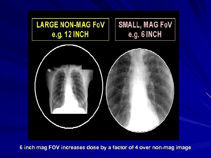 6 inch mag FOV increases dose by a factor of 4 over non-mag image