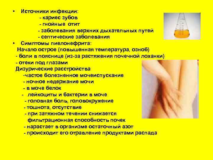  • Источники инфекции: - кариес зубов - гнойные отит - заболевания верхних дыхательных