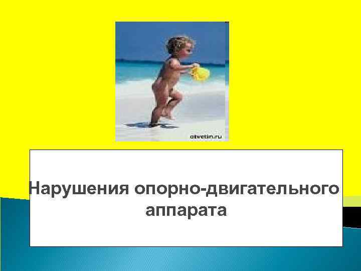 Нарушения опорно-двигательного аппарата 