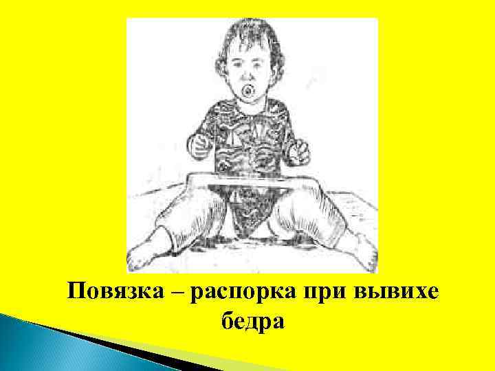 Повязка – распорка при вывихе бедра 