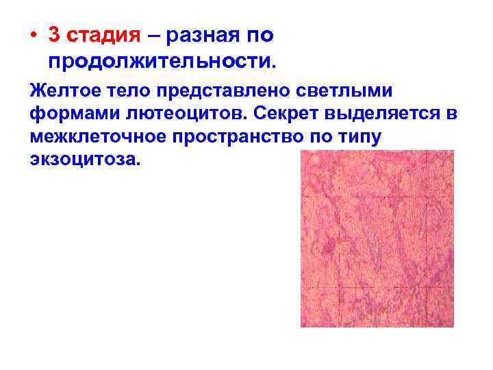  • 3 стадия – разная по продолжительности. Желтое тело представлено светлыми формами лютеоцитов.