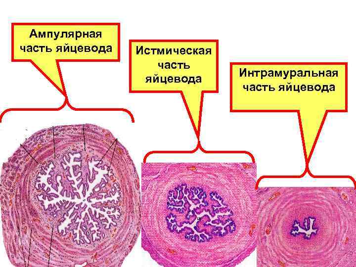 Матка препарат рисунок