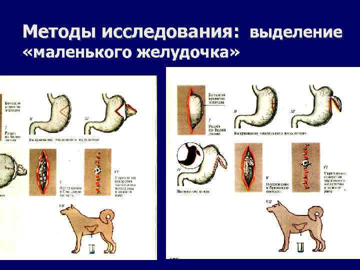 Методы исследования: выделение «маленького желудочка» 