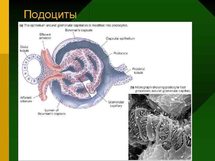 Подоциты 