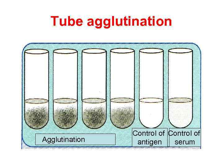 Tube agglutination Agglutination Control of antigen serum 