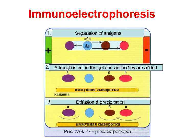 Immunoelectrophoresis Separation of antigens A trough is cut in the gel and antibodies are