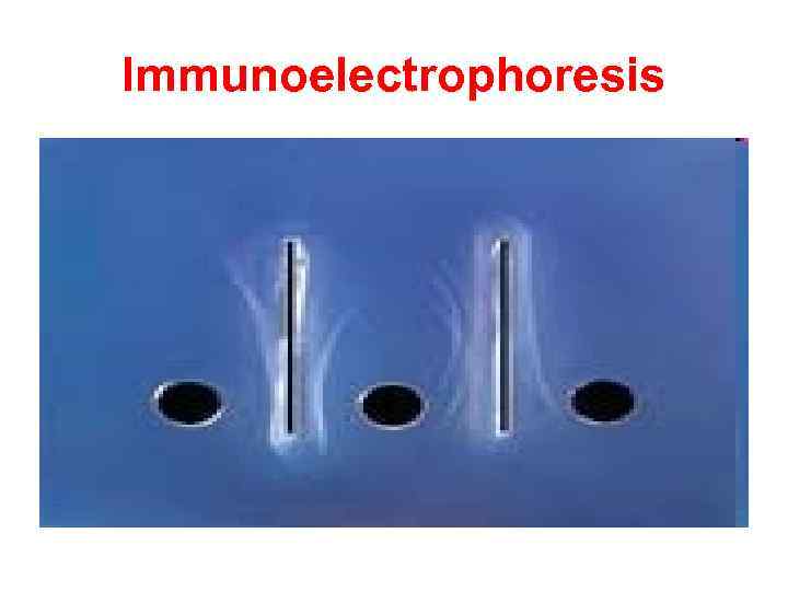 Immunoelectrophoresis 