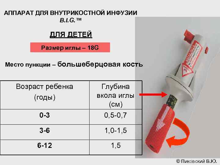 АППАРАТ ДЛЯ ВНУТРИКОСТНОЙ ИНФУЗИИ B. I. G. ™ ДЛЯ ДЕТЕЙ Размер иглы – 18