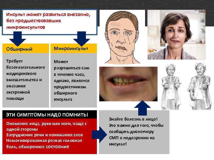 Инсульт может развиться внезапно, без предшествовавших микроинсультов Обширный Микроинсульт Требует безотлагательного медицинского вмешательства и