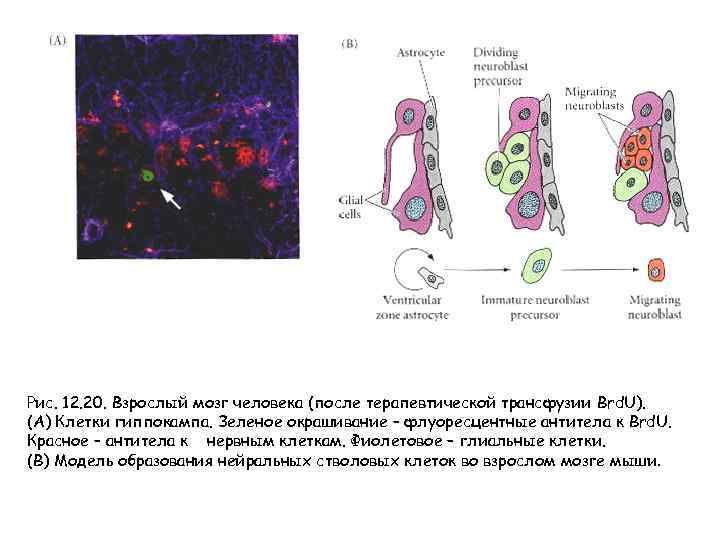 Рис. 12. 20. Взрослый мозг человека (после терапевтической трансфузии Brd. U). (А) Клетки гиппокампа.
